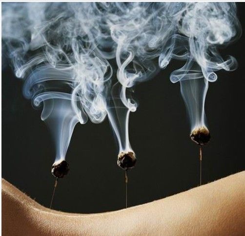 针灸留针及角度