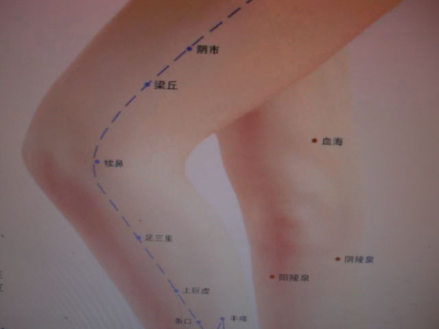 针灸得气