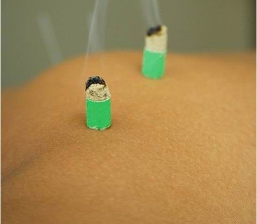 针灸